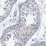 PROCA1 Antibody in Immunohistochemistry (Paraffin) (IHC (P))