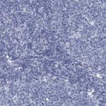 PROCA1 Antibody in Immunohistochemistry (Paraffin) (IHC (P))