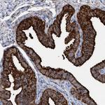 C17orf74 Antibody in Immunohistochemistry (Paraffin) (IHC (P))