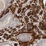 RNF19A Polyclonal Antibody