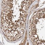 RNF19A Antibody in Immunohistochemistry (IHC)