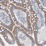 ZC3H3 Polyclonal Antibody