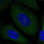 NCDN Polyclonal Antibody