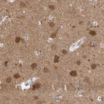 NCDN Antibody in Immunohistochemistry (Paraffin) (IHC (P))