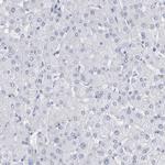 NCDN Antibody in Immunohistochemistry (Paraffin) (IHC (P))