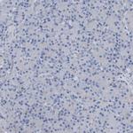 NCDN Antibody in Immunohistochemistry (Paraffin) (IHC (P))