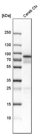 NCDN Antibody in Western Blot (WB)