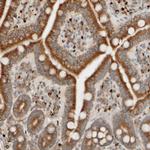 FMO1 Antibody in Immunohistochemistry (Paraffin) (IHC (P))