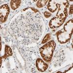FMO1 Antibody in Immunohistochemistry (Paraffin) (IHC (P))