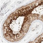 AARSD1 Polyclonal Antibody