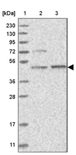 AARSD1 Antibody in Western Blot (WB)