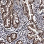 ESRP1 Antibody in Immunohistochemistry (IHC)