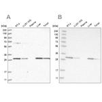 PROSC Antibody in Western Blot (WB)