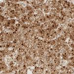 KAP3 Antibody in Immunohistochemistry (Paraffin) (IHC (P))