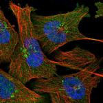 NAPRT1 Polyclonal Antibody