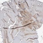 NAPRT1 Antibody in Immunohistochemistry (Paraffin) (IHC (P))