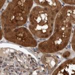NAPRT1 Antibody in Immunohistochemistry (IHC)