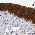 NAPRT1 Antibody in Immunohistochemistry (IHC)