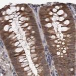 NAPRT1 Antibody in Immunohistochemistry (IHC)