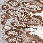 KAP3 Antibody in Immunohistochemistry (Paraffin) (IHC (P))