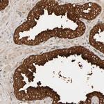 PPP1R16A Antibody in Immunohistochemistry (Paraffin) (IHC (P))