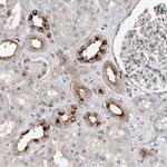 Importin 8 Antibody in Immunohistochemistry (Paraffin) (IHC (P))