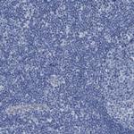 SLC34A3 Antibody in Immunohistochemistry (IHC)