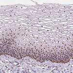 C1orf112 Polyclonal Antibody