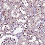 C1orf112 Antibody in Immunohistochemistry (Paraffin) (IHC (P))