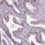 C1orf112 Antibody in Immunohistochemistry (Paraffin) (IHC (P))