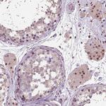C1orf112 Antibody in Immunohistochemistry (Paraffin) (IHC (P))