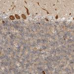 DSCC1 Antibody in Immunohistochemistry (Paraffin) (IHC (P))