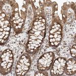 DSCC1 Antibody in Immunohistochemistry (Paraffin) (IHC (P))