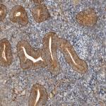 DSCC1 Antibody in Immunohistochemistry (Paraffin) (IHC (P))