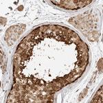 DSCC1 Polyclonal Antibody