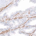 COL14A1 Antibody in Immunohistochemistry (IHC)