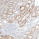 COL14A1 Antibody in Immunohistochemistry (IHC)