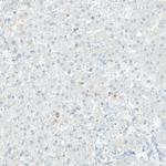 COL14A1 Antibody in Immunohistochemistry (IHC)