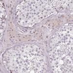 ZNF583 Polyclonal Antibody