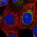 ZNF48 Polyclonal Antibody