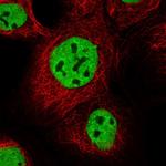 IBTK Polyclonal Antibody