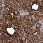 IBTK Antibody in Immunohistochemistry (Paraffin) (IHC (P))