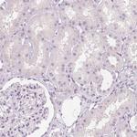 MUC12 Antibody in Immunohistochemistry (Paraffin) (IHC (P))