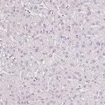 MUC12 Antibody in Immunohistochemistry (Paraffin) (IHC (P))