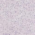 MUC12 Antibody in Immunohistochemistry (IHC)