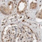ZNF521 Antibody in Immunohistochemistry (IHC)