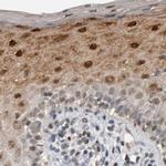 ZNF521 Antibody in Immunohistochemistry (IHC)