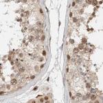 ZNF521 Antibody in Immunohistochemistry (IHC)