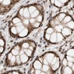 ZNF521 Antibody in Immunohistochemistry (IHC)
