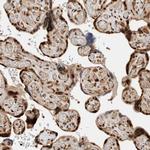 ZNF521 Antibody in Immunohistochemistry (IHC)